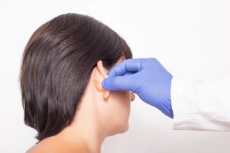 Miniatura ¿Se pueden despegar las orejas después de una otoplastia? Todo lo que necesitas saber