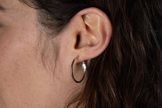 Miniatura Reducir el lóbulo de la oreja: cirugía y resultados | Otoplastia