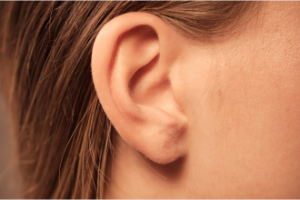 Miniatura ¿Qué son las orejas en asa? Causas y solución con otoplastia